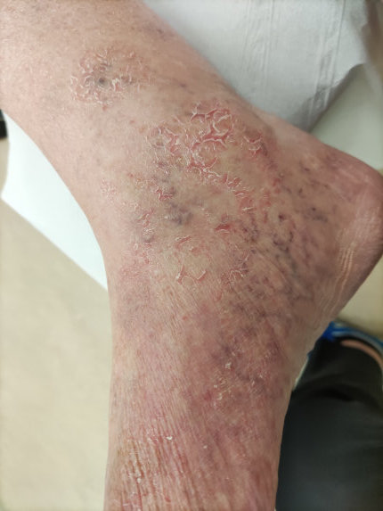 Feet standing over assesment device